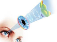 Лазерное лечение глаз в тольятти thumbnail